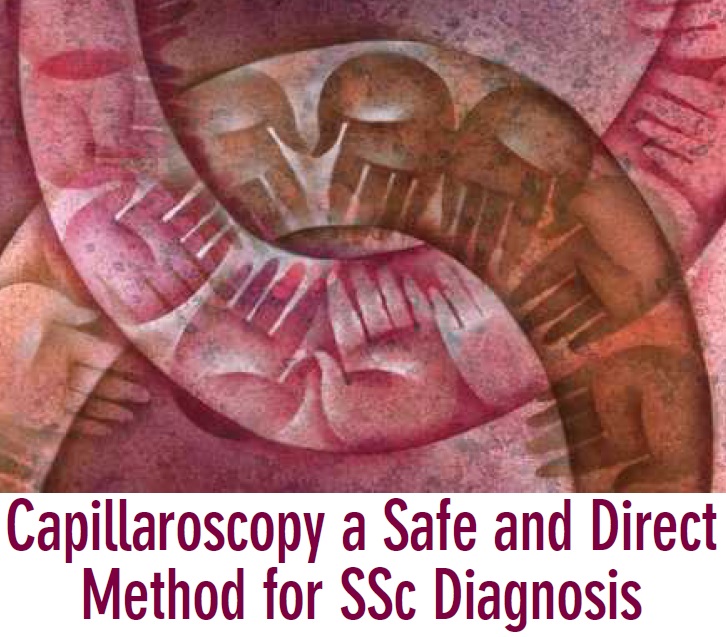 capillaroscopia_sclerodermia